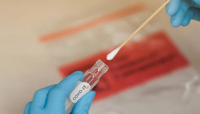 170 de îmbolnăviri de Covid19, în județul Timiș