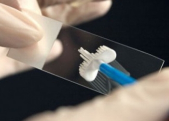 O clinică de stat din Timișoara face testări gratuite Babeș-Papanicolau