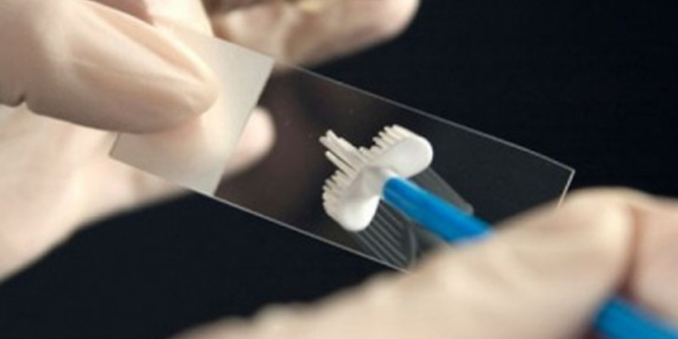 O clinică de stat din Timișoara face testări gratuite Babeș-Papanicolau