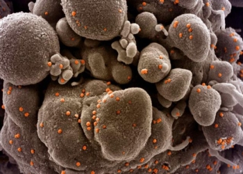 Primul caz de infectare cu tulpina indiană a virusul Sars-CoV2 a fost confirmat la Arad