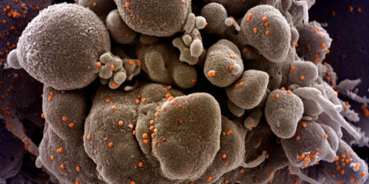 Primul caz de infectare cu tulpina indiană a virusul Sars-CoV2 a fost confirmat la Arad