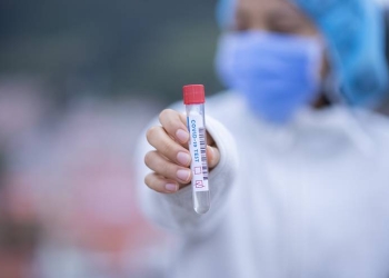 Vacanța în străinătate începe cu testarea. Cererea pentru teste antigen, mai mare cu 400% în iunie