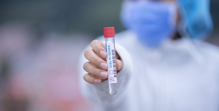 Vacanța în străinătate începe cu testarea. Cererea pentru teste antigen, mai mare cu 400% în iunie