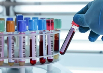 Medicii din Timișoara merg să consulte gratuit persoanele din județ