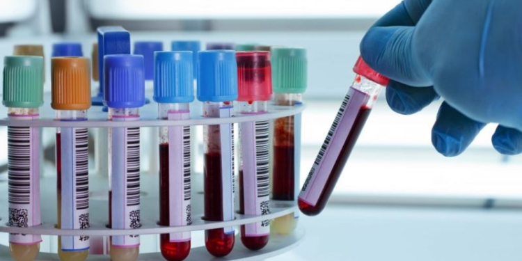 Medicii din Timișoara merg să consulte gratuit persoanele din județ