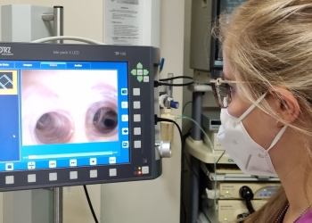 Semnal de alarmă tras de medicii de la ”Victor Babeș”: pacienții cu cancer pulmonar vin la spital într-un stadiu avansat al bolii