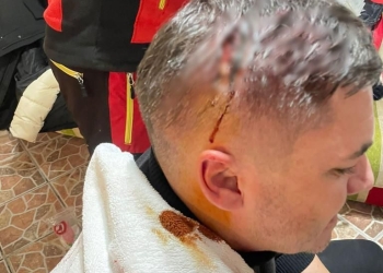 Fostul viceprimar al comunei Corbeanca, agresat de patronii unui hotel de pe Muntele Mic