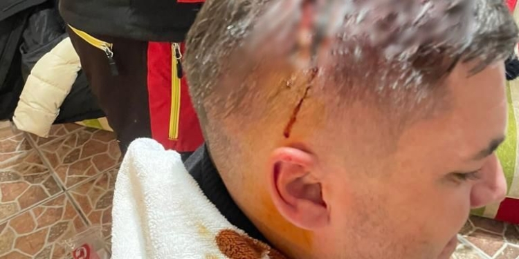 Fostul viceprimar al comunei Corbeanca, agresat de patronii unui hotel de pe Muntele Mic