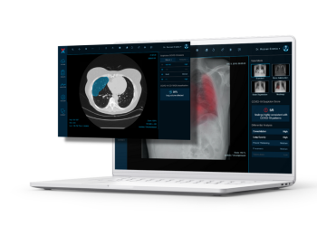 Investiție de 1 milion de euro într-un start-up din Timișoara! XVision se extinde și în SUA