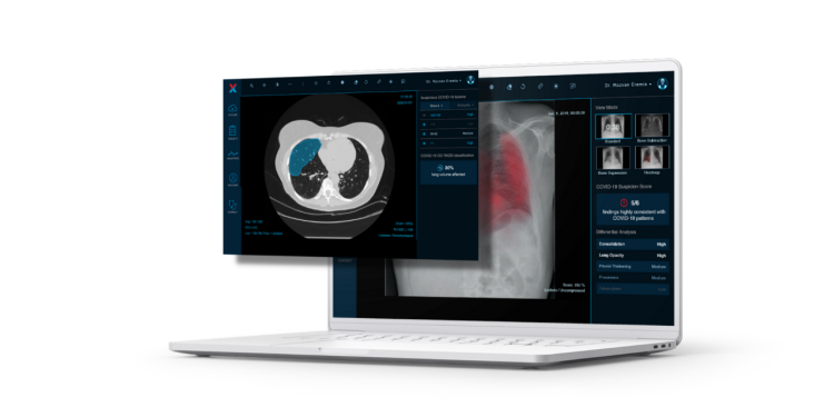 Investiție de 1 milion de euro într-un start-up din Timișoara! XVision se extinde și în SUA