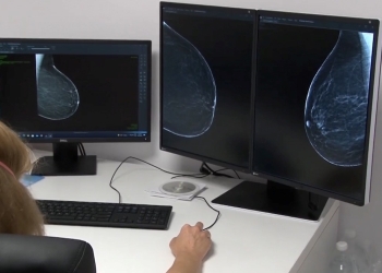 Mamografii gratuite și spitalul „Victor Babeș” din Timișoara