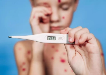 Carantină obligatorie pentru persoanele infectate cu variola maimuței. Află care este țara care a introdus