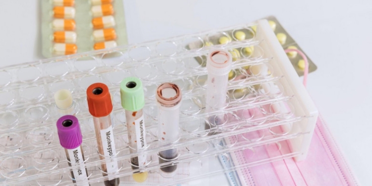 Primul caz de variola maimuței diagnosticat în România