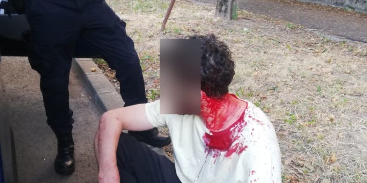 S-au bătut până s-au umplut de sânge