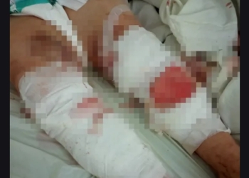 O bătrână din Timiș a fost desfigurată de o haită de câini