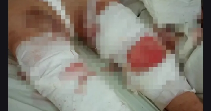 O bătrână din Timiș a fost desfigurată de o haită de câini