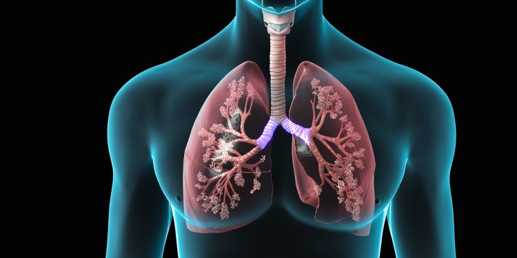 Spitalul de Boli Infecțioase din Timișoara vrea să realizeze transplanturi de plămâni