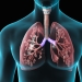 Spitalul de Boli Infecțioase din Timișoara vrea să realizeze transplanturi de plămâni