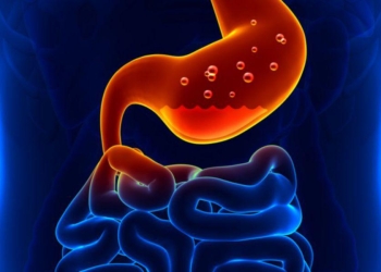 Medic timișorean: „Bolile gastrointestinale se numără printre cele mai frecvente afecțiuni de care ne lovim”