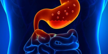 Medic timișorean: „Bolile gastrointestinale se numără printre cele mai frecvente afecțiuni de care ne lovim”