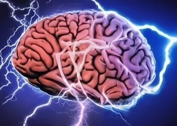 Aparat performant pentru diagnosticarea pacienților cu tulburări neurologice, la Spitalul CFR din Timișoara