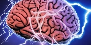 Aparat performant pentru diagnosticarea pacienților cu tulburări neurologice, la Spitalul CFR din Timișoara