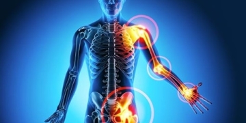 Infiltrațiile, soluțiile de tratament ce pot fi realizate și la Spitalul CFR din Timișoara