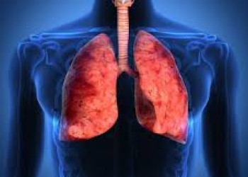 Peste o mie de pacienți cu pneumonie, internați la Timișoara în acest an