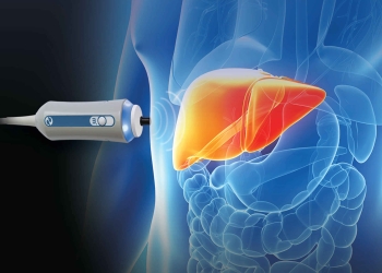 Investigații gratuite la OncoHelp, cu un aparat performant care evaluează starea de sănătate a ficatului