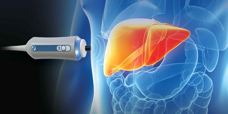 Investigații gratuite la OncoHelp, cu un aparat performant care evaluează starea de sănătate a ficatului