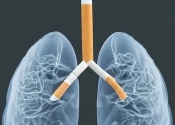 Medic timișorean: emfizemul pulmonar, boala care duce la dificultăți de respirație, provocată de fumat