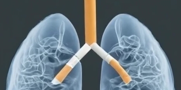 Medic timișorean: emfizemul pulmonar, boala care duce la dificultăți de respirație, provocată de fumat