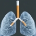 Medic timișorean: emfizemul pulmonar, boala care duce la dificultăți de respirație, provocată de fumat
