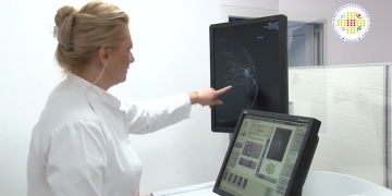 Mamografii gratuite pentru depistarea cancerului de sân, la Spitalul „Victor Babeș” din Timișoara