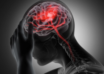 Spitalul CFR din Timișoara: Fiecare secundă contează atunci când o persoană suferă un accident vascular cerebral