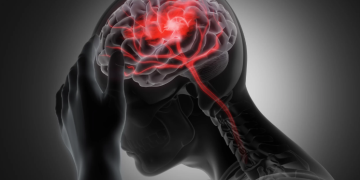 Spitalul CFR din Timișoara: Fiecare secundă contează atunci când o persoană suferă un accident vascular cerebral