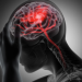 Spitalul CFR din Timișoara: Fiecare secundă contează atunci când o persoană suferă un accident vascular cerebral