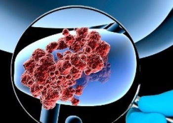 Spitalul „Victor Babeș” din Timișoara: 1 din 8 bărbați ajunge să aibă cancer de prostată