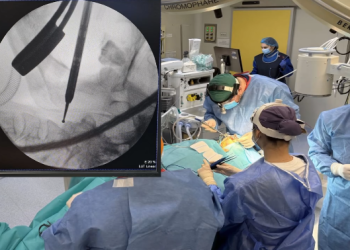 Operație în premieră la Spitalul Județean Timișoara, pentru stabilizarea unei fracturi cervicale