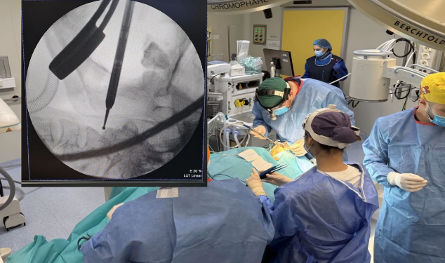 Operație în premieră la Spitalul Județean Timișoara, pentru stabilizarea unei fracturi cervicale