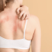 O afecțiune dermatologică caracterizată prin apariția unor noduli duri, tratată la Spitalul CFR din Timișoara