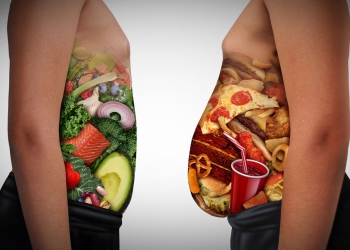 Medic timișorean: Obezitatea este principala cauză a deceselor și îmbolnăvirilor ce pot fi prevenite