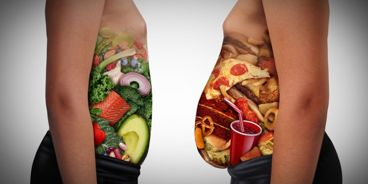 Medic timișorean: Obezitatea este principala cauză a deceselor și îmbolnăvirilor ce pot fi prevenite