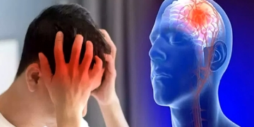 Spitalul CFR din Timișoara, despre accidentul vascular cerebral: Boala se declanșează brusc și fiecare minut contează