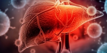 Creștere a numărului de cazuri de hepatită A la Spitalul „Victor Babeș” din Timișoara