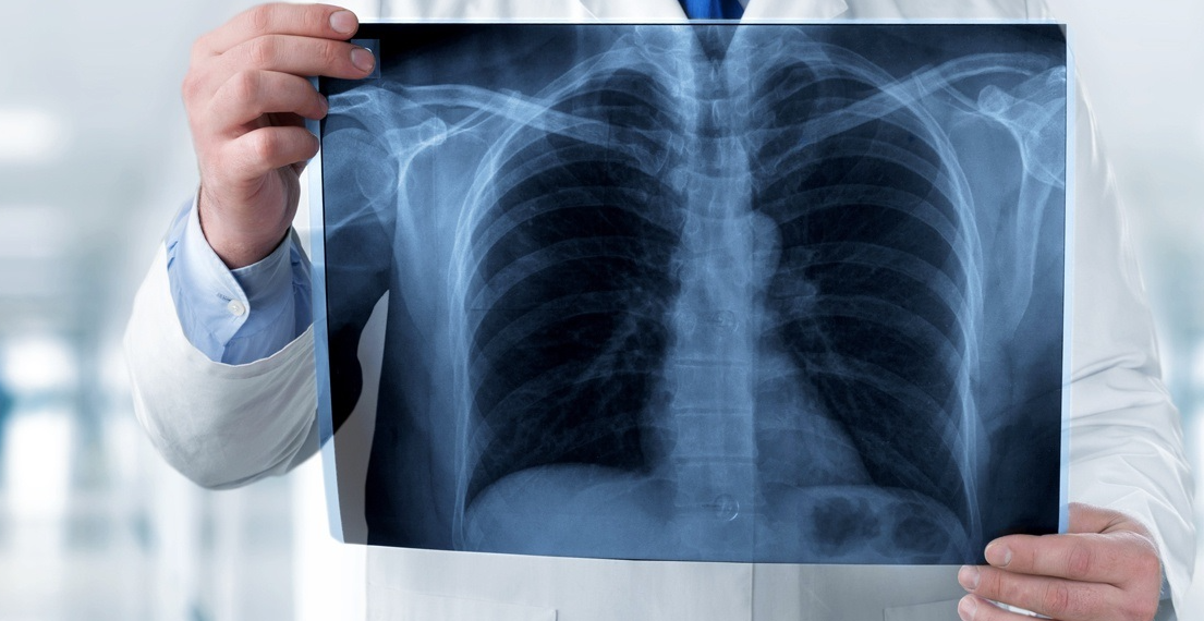 Inteligența artificială în radiologie, implementată în premieră națională la Spitalul Municipal Timișoara