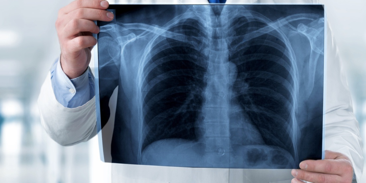 Inteligența artificială în radiologie, implementată în premieră națională la Spitalul Municipal Timișoara