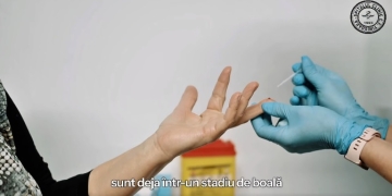 Testare gratuită pentru depistarea hepatitei C la Spitalul Clinic CF Timișoara