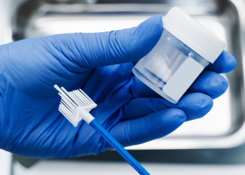 Testări gratuite, fără bilet de trimitere, pentru depistarea cancerului de col uterin, la Centrul OncoHelp din Timișoara