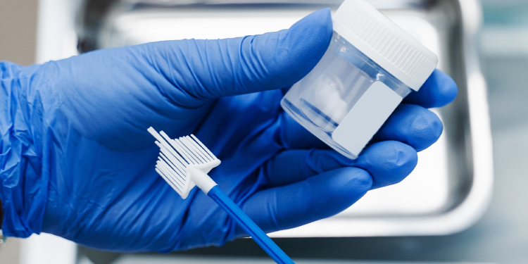 Testări gratuite, fără bilet de trimitere, pentru depistarea cancerului de col uterin, la Centrul OncoHelp din Timișoara